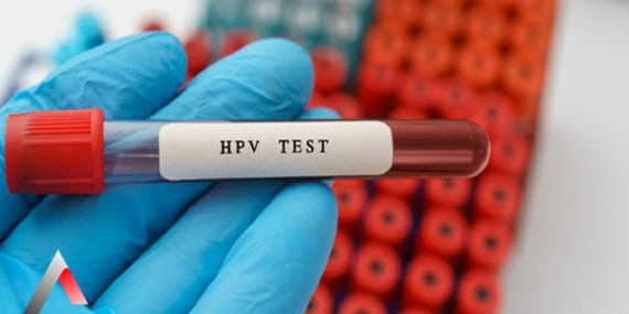 HPV Testi Nasıl Yapılır Adım Adım Bilgilendirme